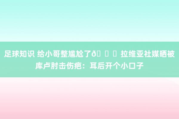 足球知识 给小哥整尴尬了😅拉维亚社媒晒被库卢肘击伤疤：耳后开个小口子